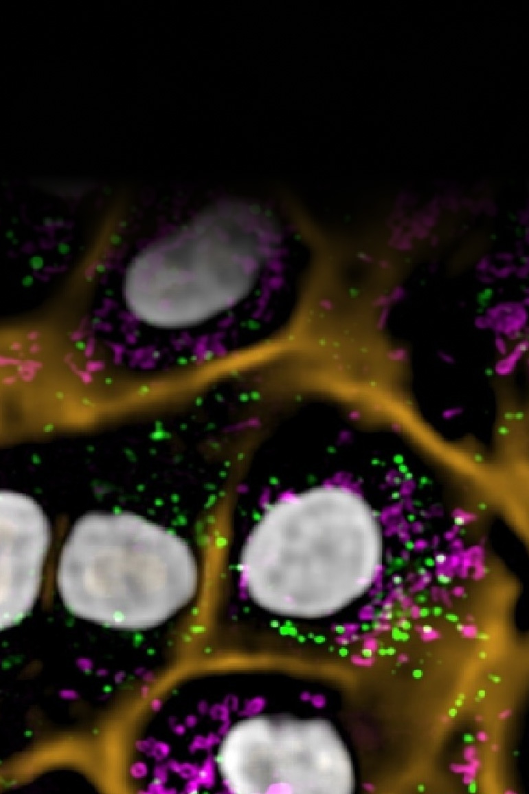 Fluorescent microscopy image showing cell structures with highlighted organelles in green, magenta, and orange.