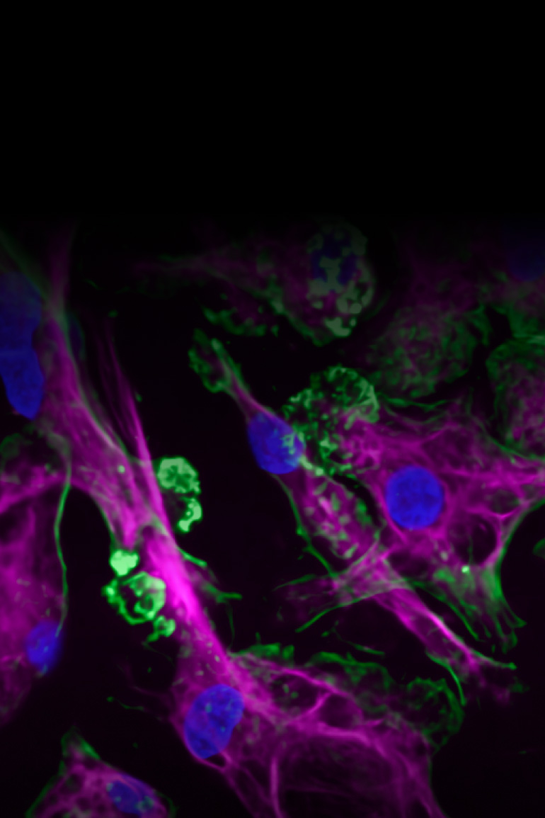 Shows human macrophages with blue, green, and magenta markers.